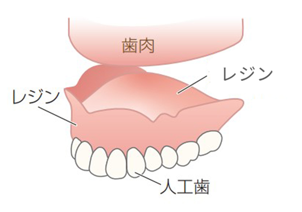 レジン総入れ歯イメージ